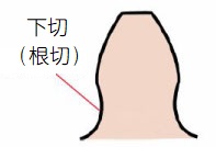 根切